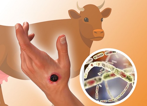 Waspada! Penyakit Antraks Sulit Diberantas, Sporanya Bisa Masuk Lewat Kulit